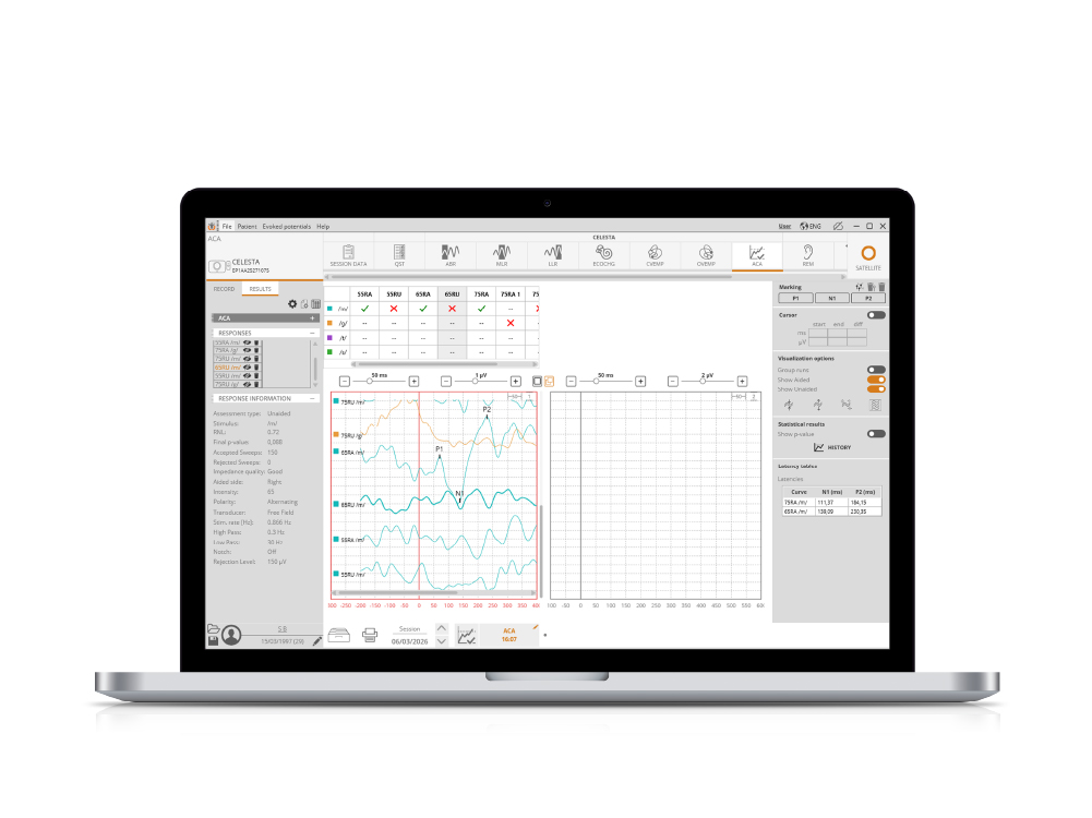 HEARLab® ACA visualization 1