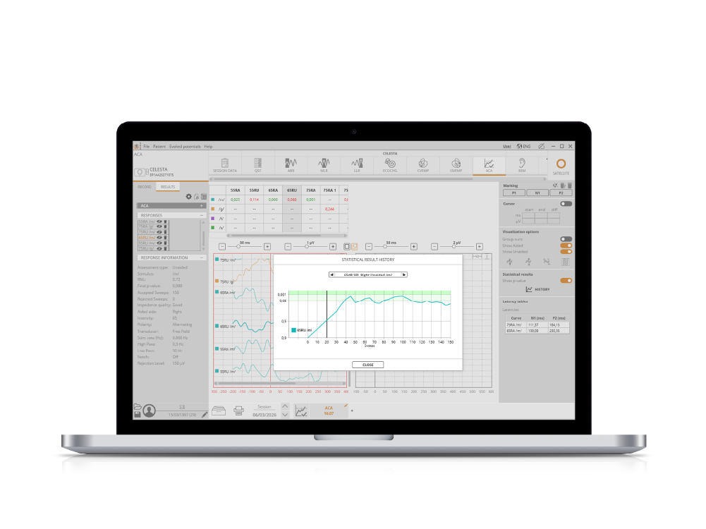 HEARLab® ACA visualization 2